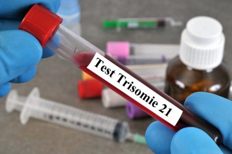test trisomie 21